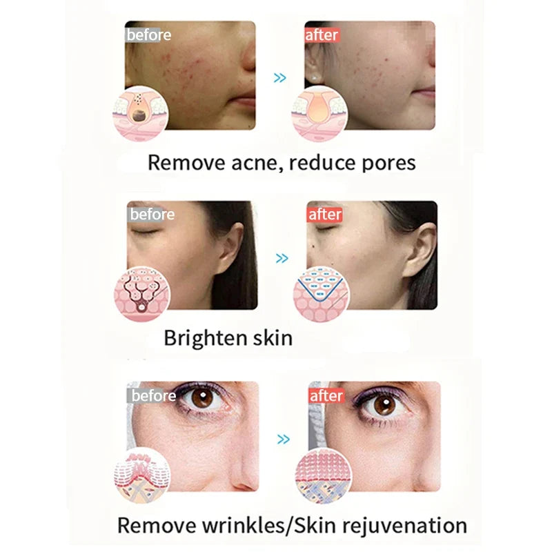 3-Color LED Light Therapy Face Mask